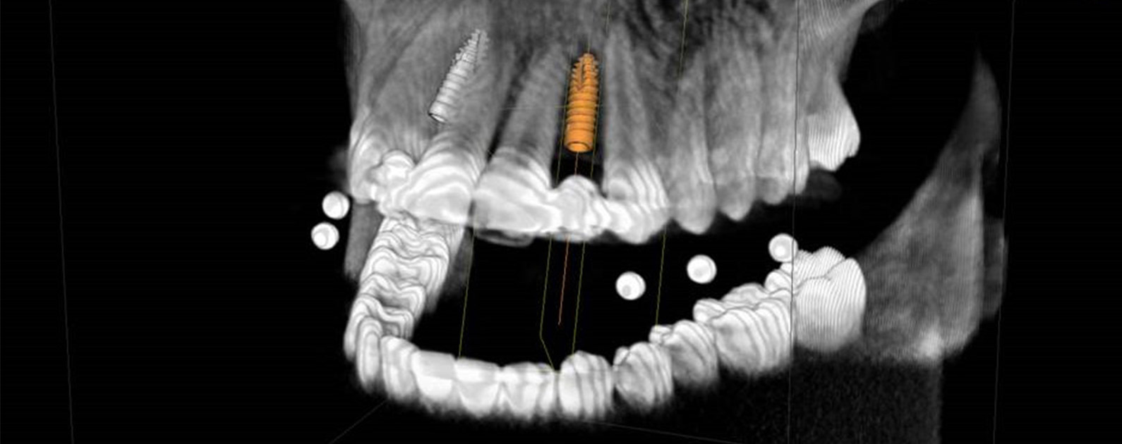 3D-Röntgen Soest, 3D-Diagnostik mit DVT